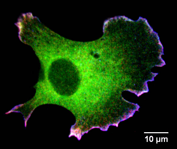 a Rat2 cell